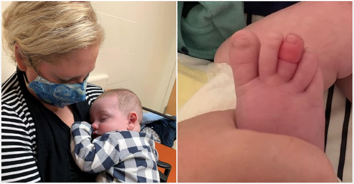 Mom is warning parents about a rare condition that affects babies after her baby son had to be rushed to the ER and almost lost his toe