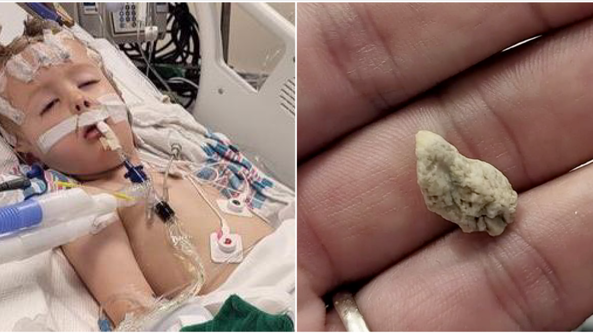Toddler is fighting for his life after he went into cardiac arrest, which stopped his heart for around 12 minutes, because he swallowed a rock while playing at daycare