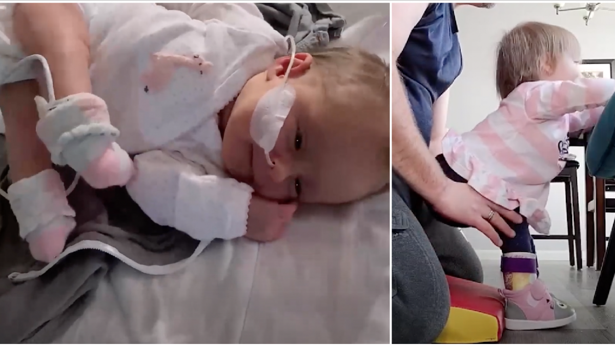 Baby girl, who underwent spinal surgery while still inside her mother’s womb, has defied the doctors who said she wouldn’t be able to use her legs properly by learning how to walk