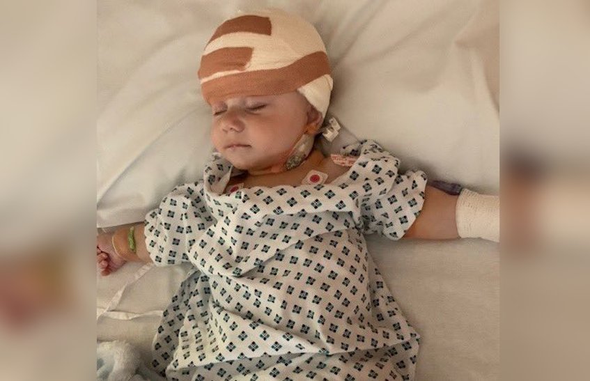 “Doctors told me not to read up about the surgery but I was watching YouTube videos about it”, Baby born with a rare condition needed life-saving surgery at just 4-months-old to have his head fixed, his mom said
