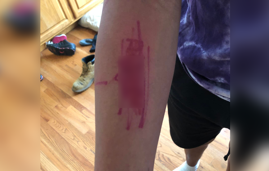 “I was confused on why she would write that on my arm”, Parents claim the school administration refused to investigate and discipline white classmates for writing the N-word on their son’s paper and on his arm